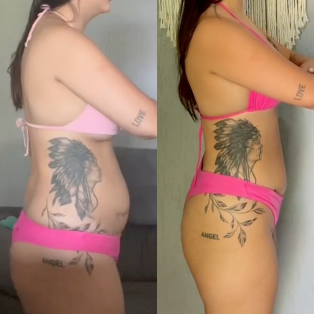 Foto de antes e depois de aluna do desafio